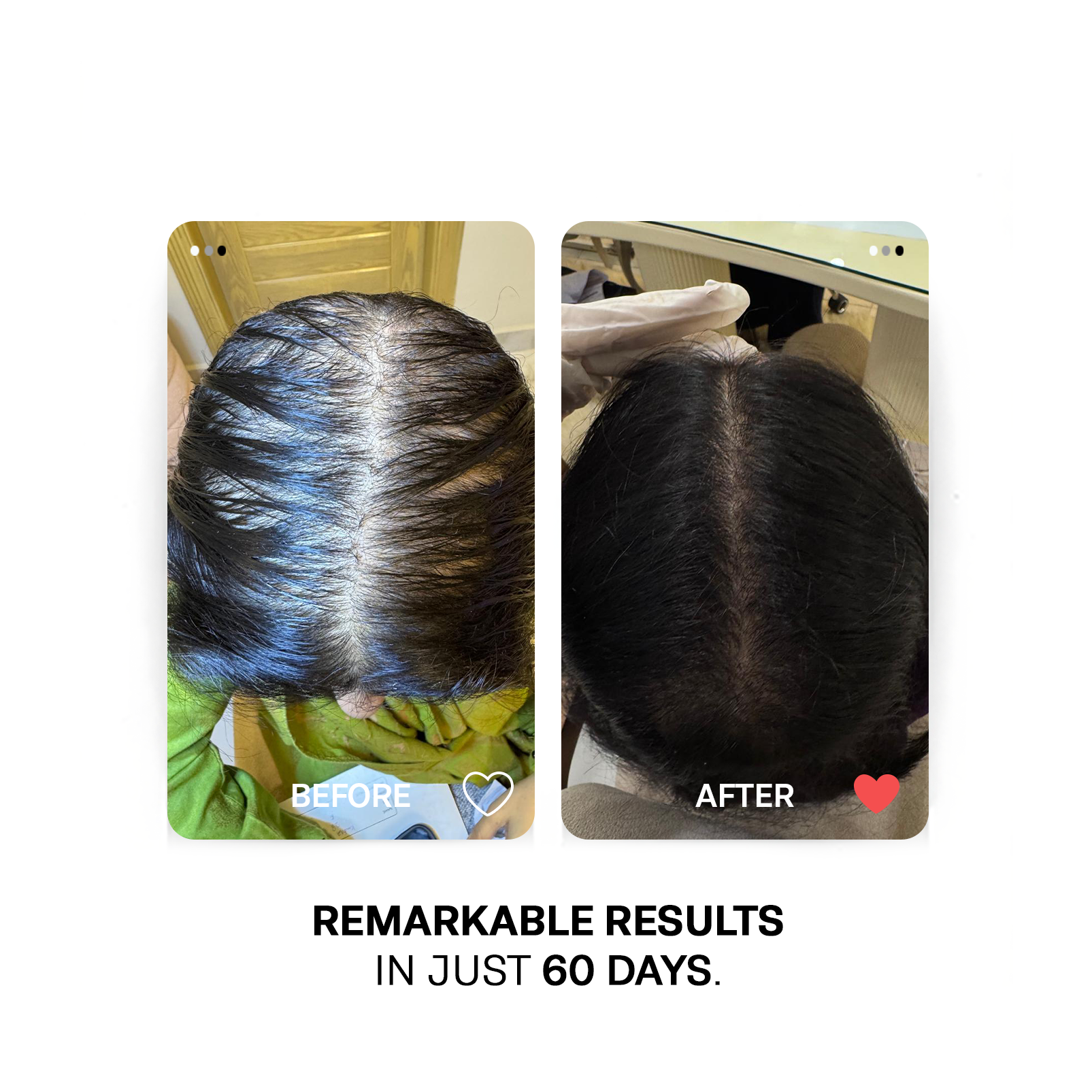 GroPlus - Hair Nails & Skin Supplements | Advanced Hair Growth Supplements